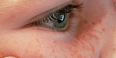 每天认真保养，斑点还是默默地冒出来。其实斑的出现不只是年龄和老化的问题，现在就一起来认识一下常见的斑是怎么跑出来的吧。