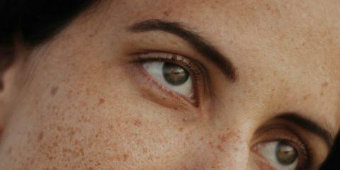 不想经历点痣后的修复期，让你对点痣膏心动了吗?但是点痣膏可不能随意使用的，可能会留下疤甚至让你忽略的健康警讯。现在就让本篇文章带你了解点痣膏以及癌化的前兆吧。