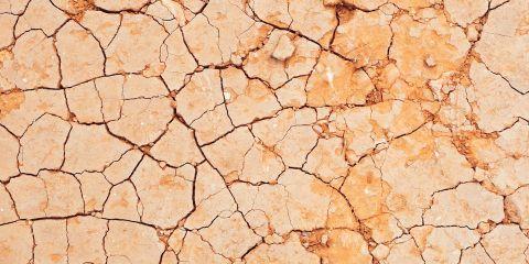 干燥脱皮可不是干性肌肤专属!长时间单在空调房、过度清洁、随意保养，都是造成肌肤变干甚至脱皮的原因。今天就让本篇文章来告诉你为什么会干燥脱皮的真相吧。