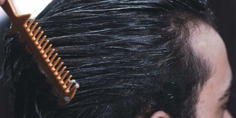 你以为「雄性秃」只会发生在男性身上吗?其实也有不少女性深受其扰!今天就让本篇文章来带你了解雄性秃，帮助你守住发量。