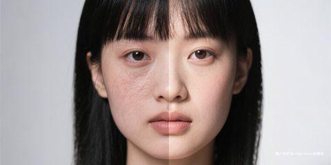 在皮肤科临床中，「油水平衡」与「肌肤屏障」始终是两个密不可分的核心概念。
许多肌肤问题，如干燥、敏感、出油、粉刺与泛红，往往都与这两者失调有关。
从医师的角度来看，想要维持皮肤健康，必须同时注重油水平衡的调整与屏障功能的修护。