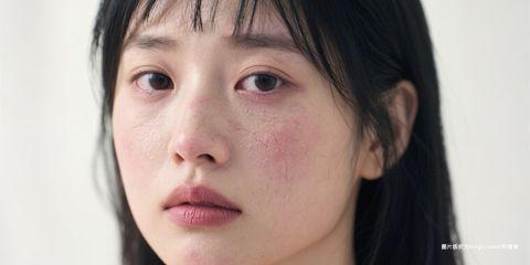 敏感肌肤在日常护理中常面临两大挑战：一方面需要维持 油水平衡，另一方面又必须避免过度刺激。
当屏障功能不稳定时，皮肤容易缺水，同时因补偿作用而增加皮脂分泌，导致外油内干与反覆泛红。
其实，只要掌握正确的保养原则，敏感肌也能稳定达成油水平衡。