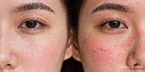 在日常生活中，许多人会将「皮肤敏感」与「过敏」混为一谈，认为两者是相同的现象。然而，从医学与皮肤学角度来看，敏感与过敏有着本质上的不同。正确区分两者，不仅有助于找出不适的根源，也能帮助人们选择更合适的护理方式。