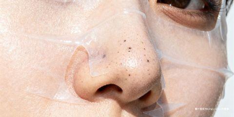 黑头粉刺（Blackheads）是毛孔被皮脂、角质堵塞，经氧化后呈现黑色的皮肤问题。由于其常见于鼻头与 T 区，影响外观细致度，许多人寄望于「敷面膜」来改善黑头。然而，面膜种类繁多，效果与迷思也层出不穷。本文将解析敷面膜对黑头的实际作用，并破解常见误解。