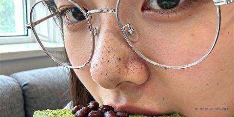 黑头粉刺（Blackheads）属于开放性粉刺，形成原因与皮脂分泌过多、角质代谢异常与毛孔堵塞有关。除了外部清洁与保养，饮食习惯对皮肤状态也有重要影响。现代研究显示，高糖、高脂或特定食物可能会加剧皮脂腺活性，导致黑头与痘痘恶化。本文将整理出容易加重黑头的饮食类别，作为日常护肤的饮食避雷清单。