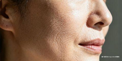 细纹与皱纹是皮肤老化最常见的表现，其中胶原蛋白（Collagen）与弹力纤维（Elastin）的流失，是导致纹路产生与加深的核心因素。这两种蛋白质构成皮肤真皮层的主要支撑结构，一旦含量下降或排列受损，皮肤便会失去弹性与紧致，进而出现明显纹路。本文将深入解析胶原蛋白与弹力纤维在皮肤中的角色，以及它们流失后对细纹的影响。