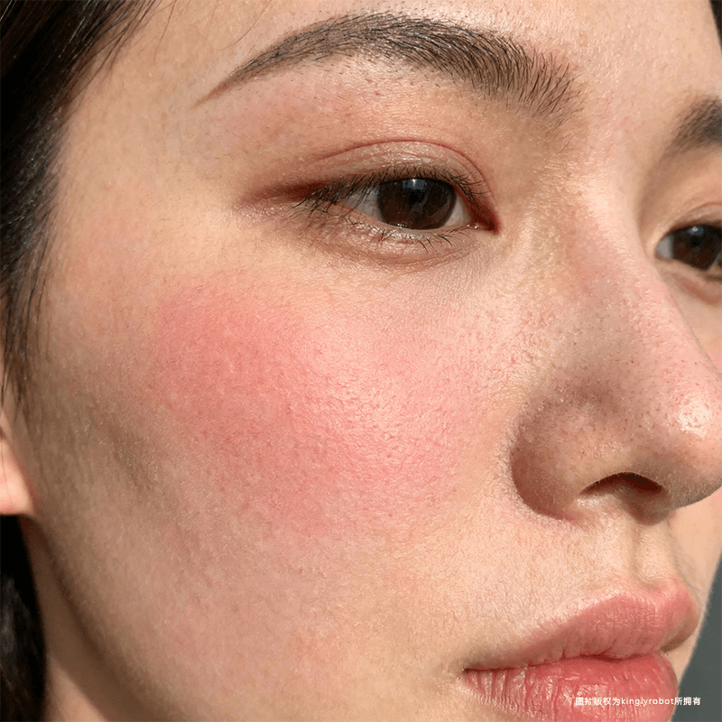 什么是皮肤敏感？