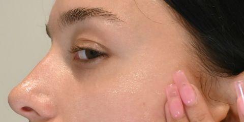 皮脂腺与汗腺是皮肤结构之真皮层中决定肤质的两种腺体,汗腺分泌的汗水和皮脂腺分泌的皮脂会在肌肤表面形成一层酸膜,是决定肤质的天然保护膜,有抑制细菌和滋润皮肤的功能。今天就让我们一起来认识皮脂腺的关键功能吧。