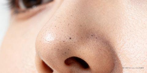 黑头粉刺(Blackheads)是油脂分泌、角质堆积与毛孔氧化作用的结果,常见于鼻翼、额头与下巴。日常清洁不仅能去除表面油脂与污垢,更是预防黑头恶化的基础。然而,错误的洁面产品选择,可能让皮肤屏障受损、刺激皮脂分泌过多,使黑头问题加剧。本文将解析洁面产品挑选的原则,并提供专业建议。
