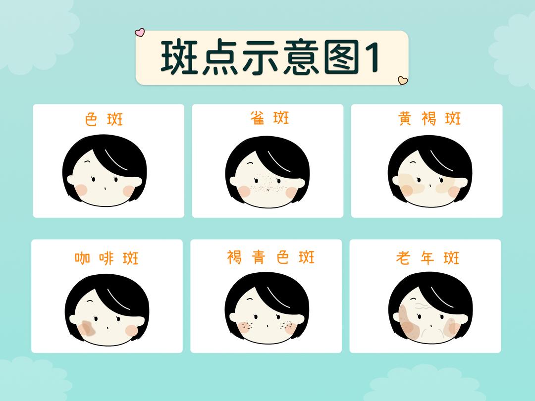 常见的斑有哪些呢?