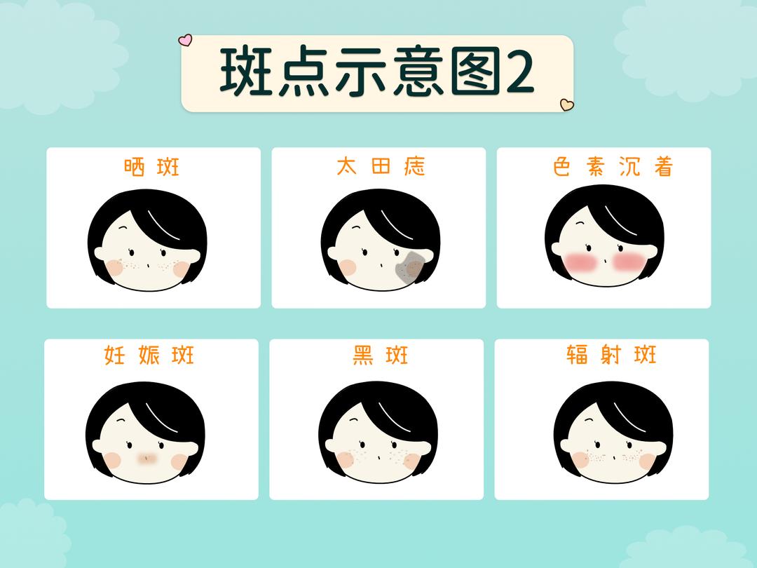 常见的斑有哪些呢?