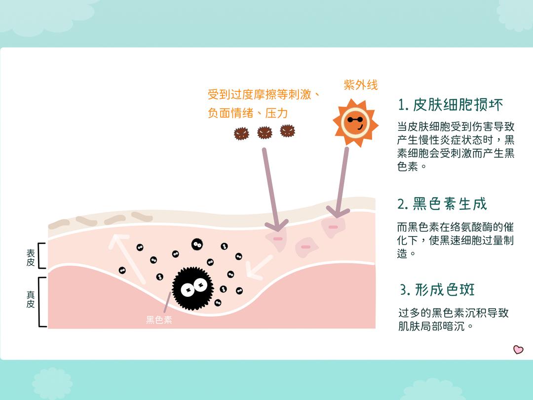 长斑的因素有那些?