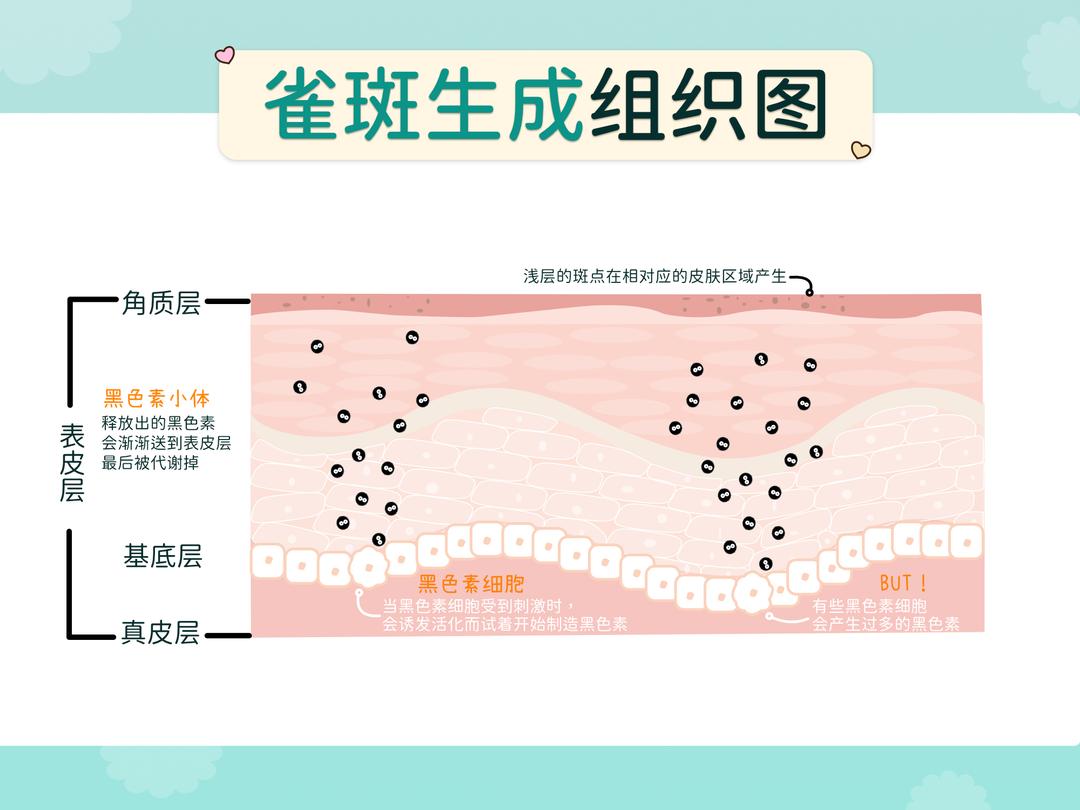 年轻族群好发的斑有哪些?