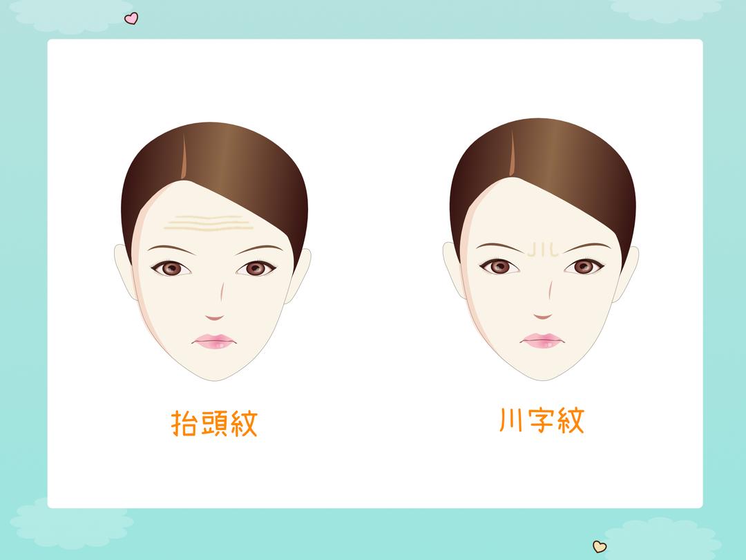 抬头纹/抬眉纹