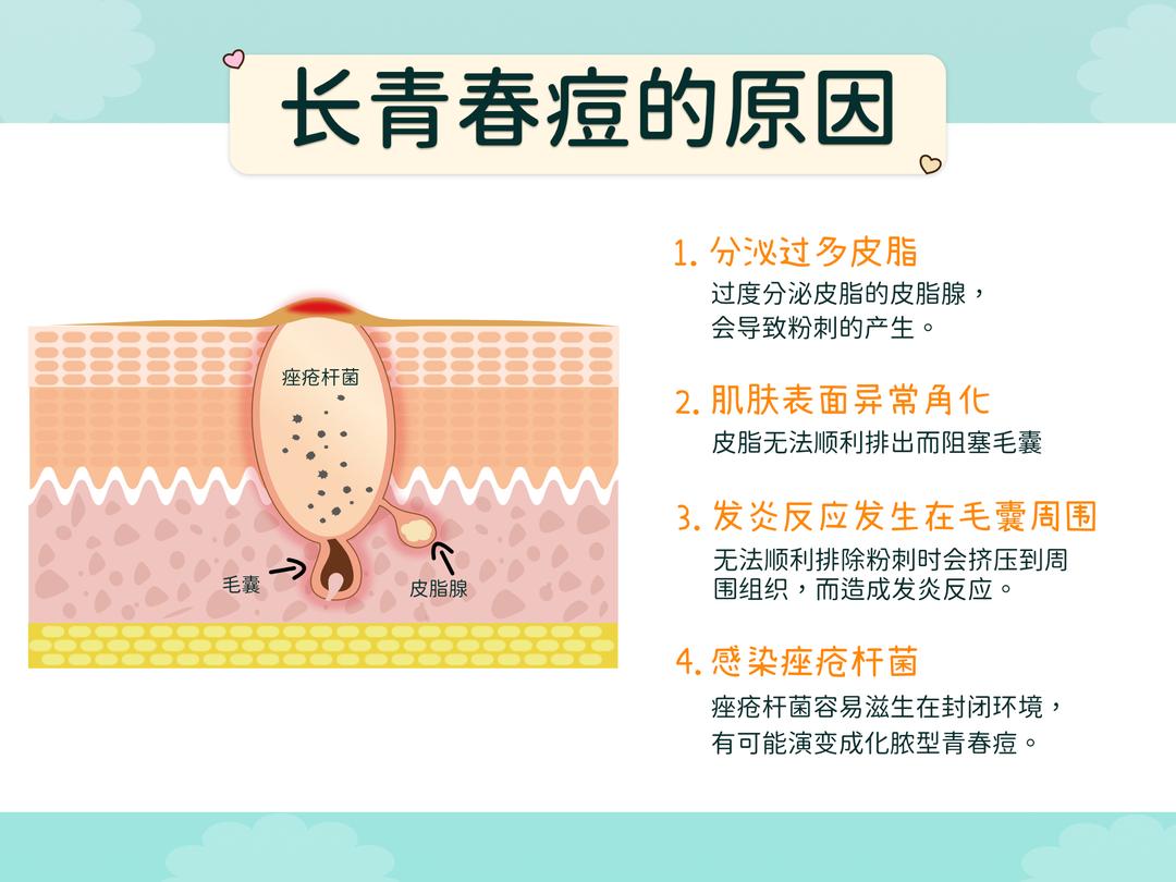 为什么会长青春痘?
