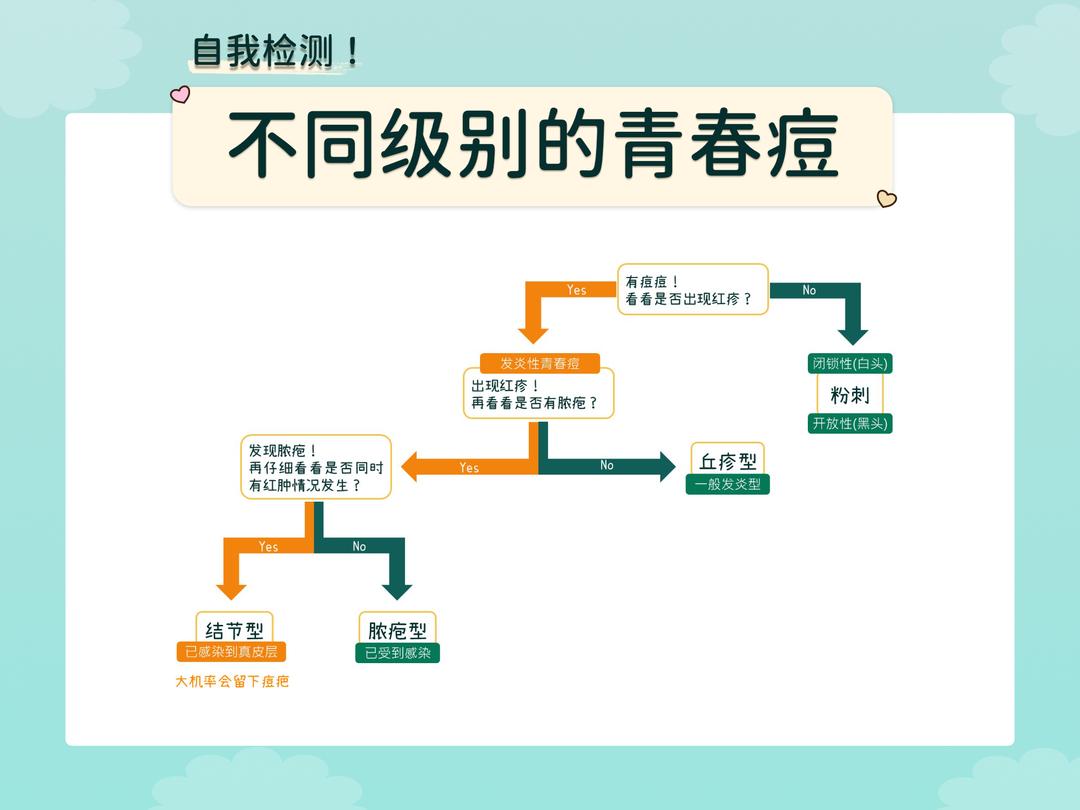 你属于哪种程度的青春痘?