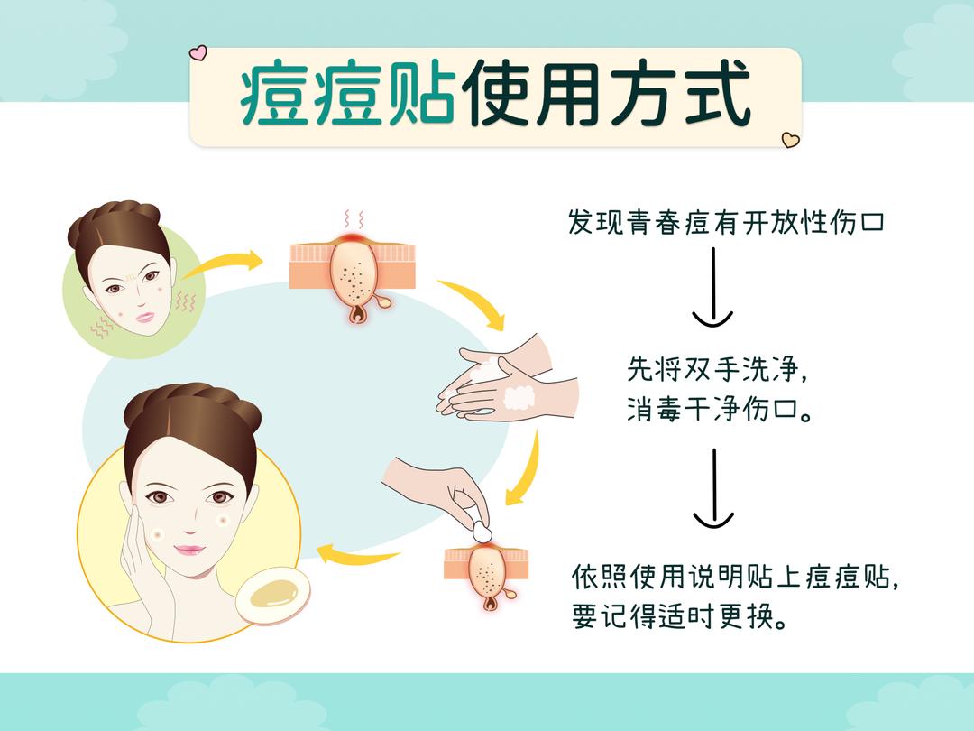 痘痘贴的使用步骤