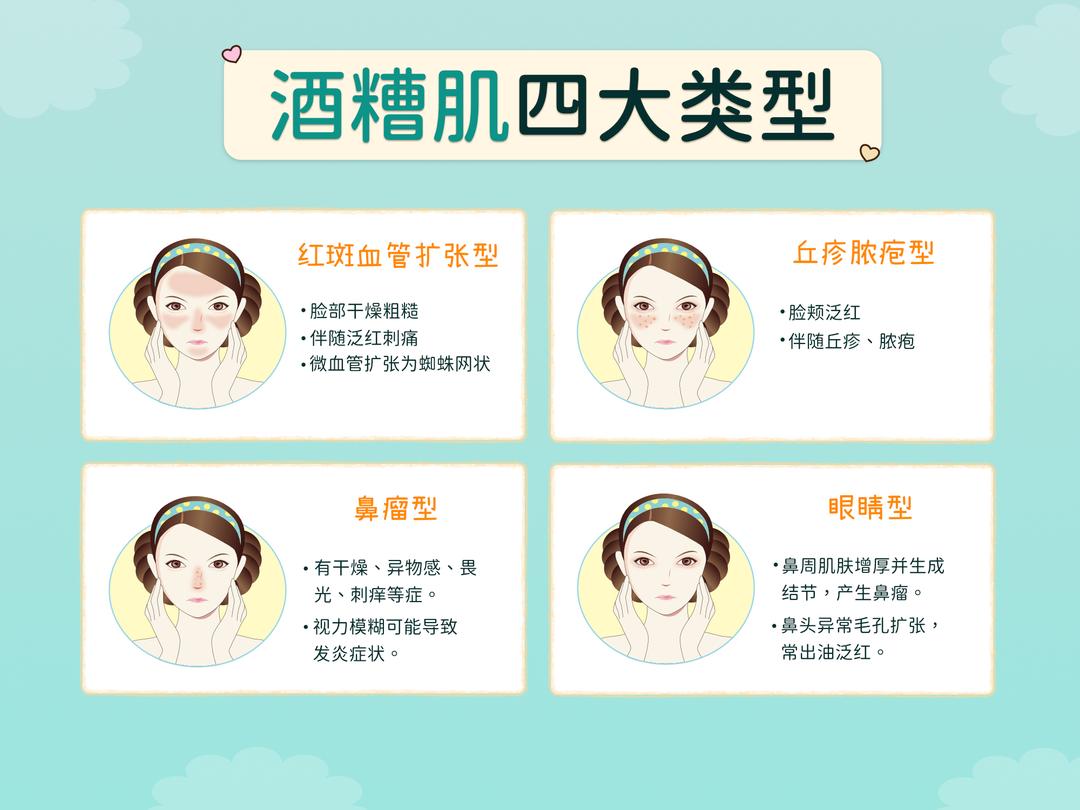 酒糟肌分为哪些类型?