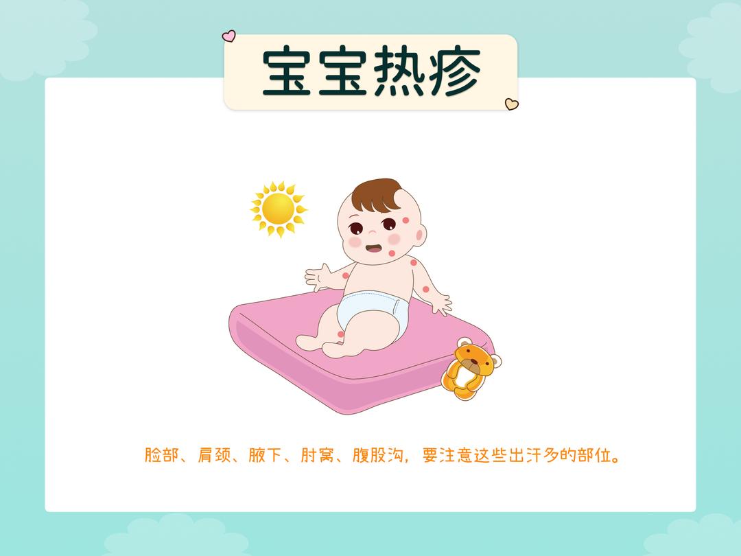 宝宝肌肤问题-汗疹