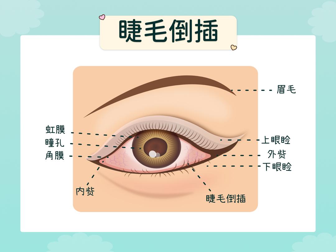 睫毛的生长方向很重要!