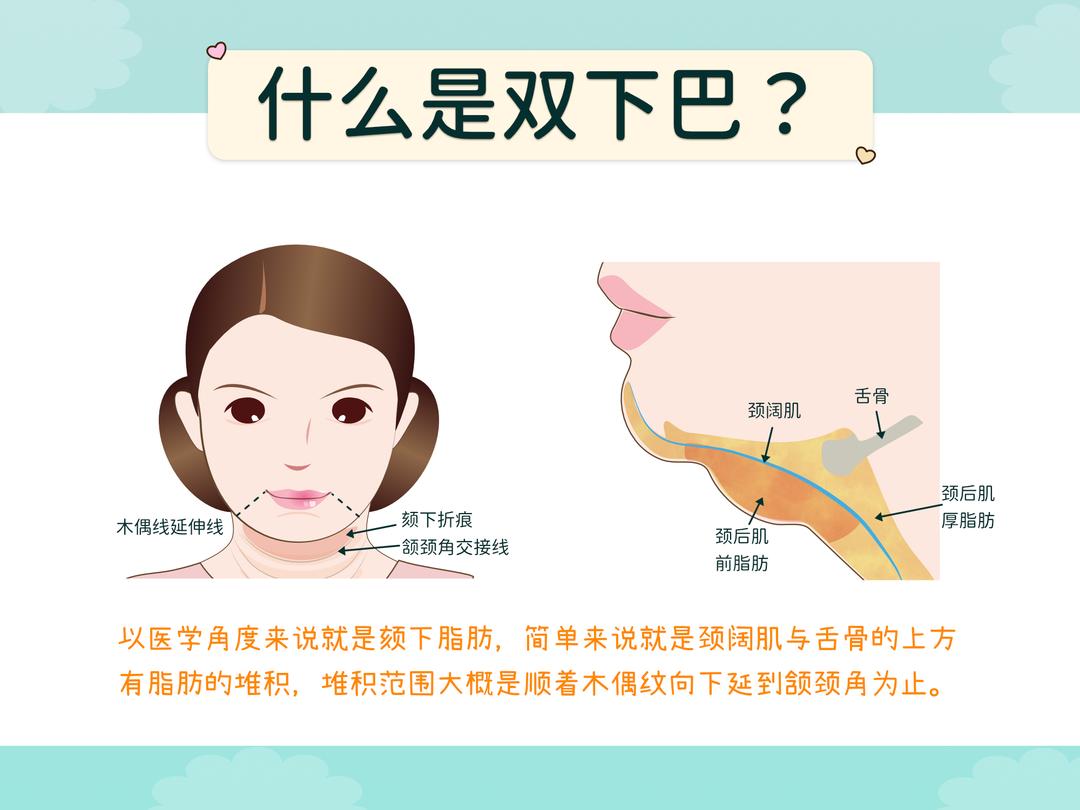 为什么有双下巴?