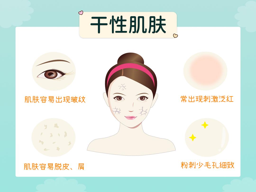 你属于哪种干性肌肤