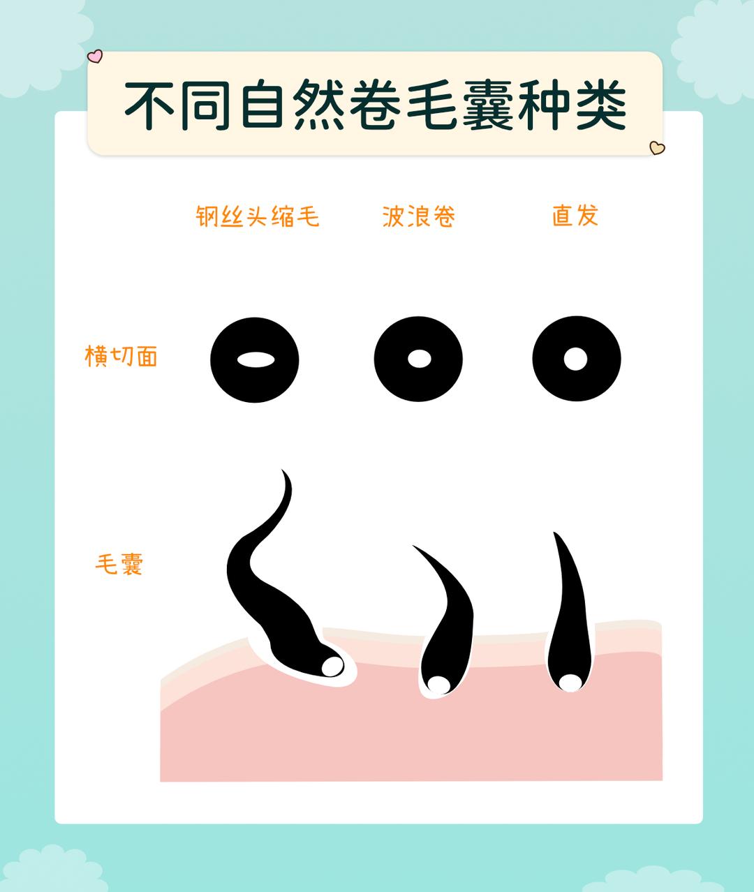 自然卷的四大类型!