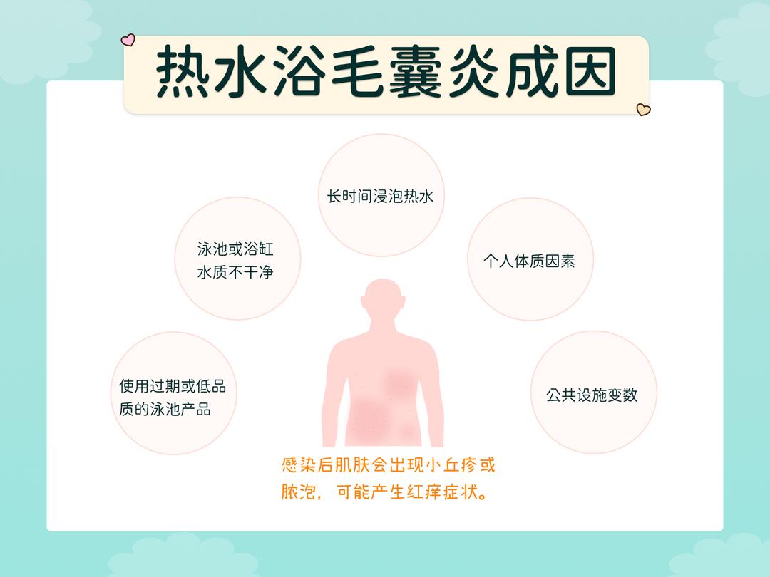 产生热水浴毛囊炎的原因
