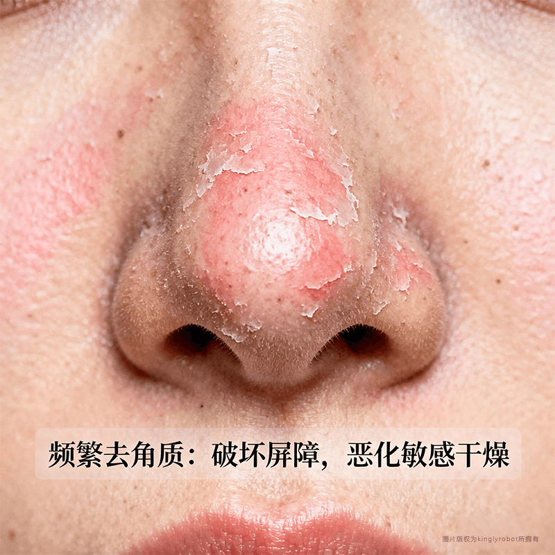 常见的错误处理方式