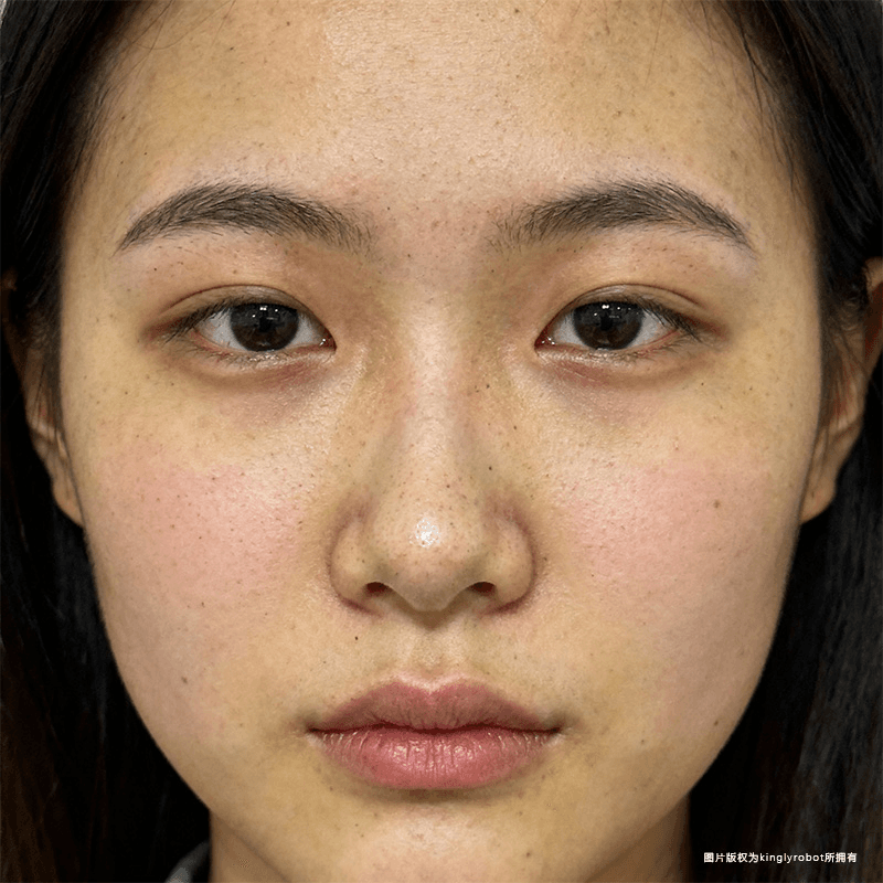 毛孔问题与环境污染的关联