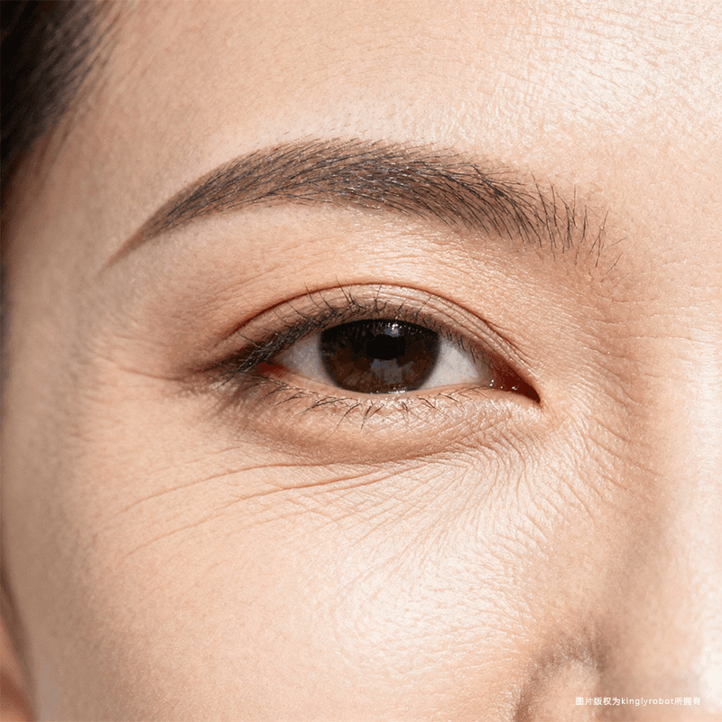 眼周细纹:最脆弱的区域