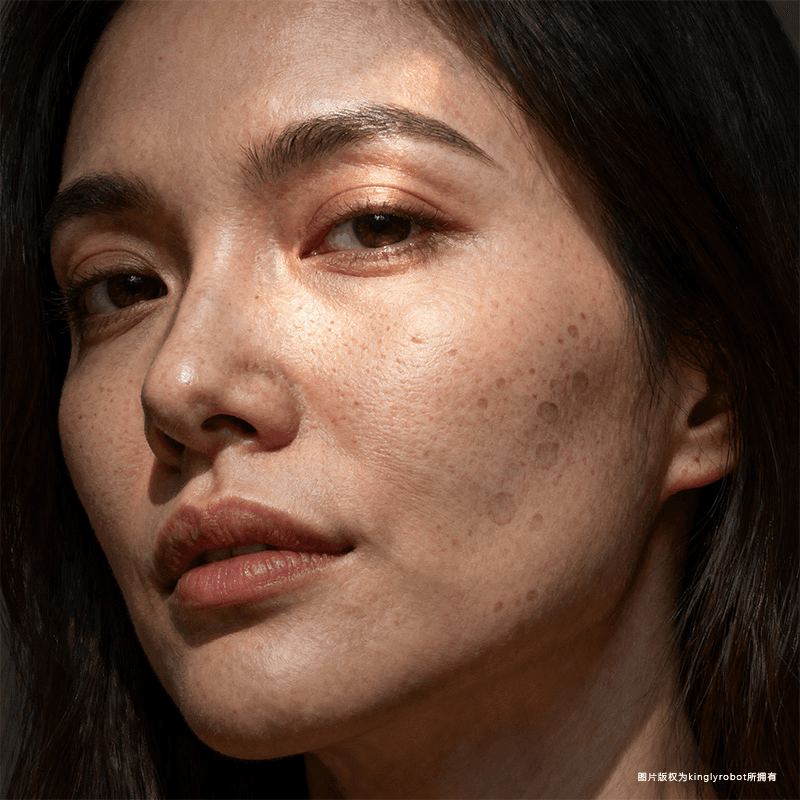 紫外线如何加速毛孔老化