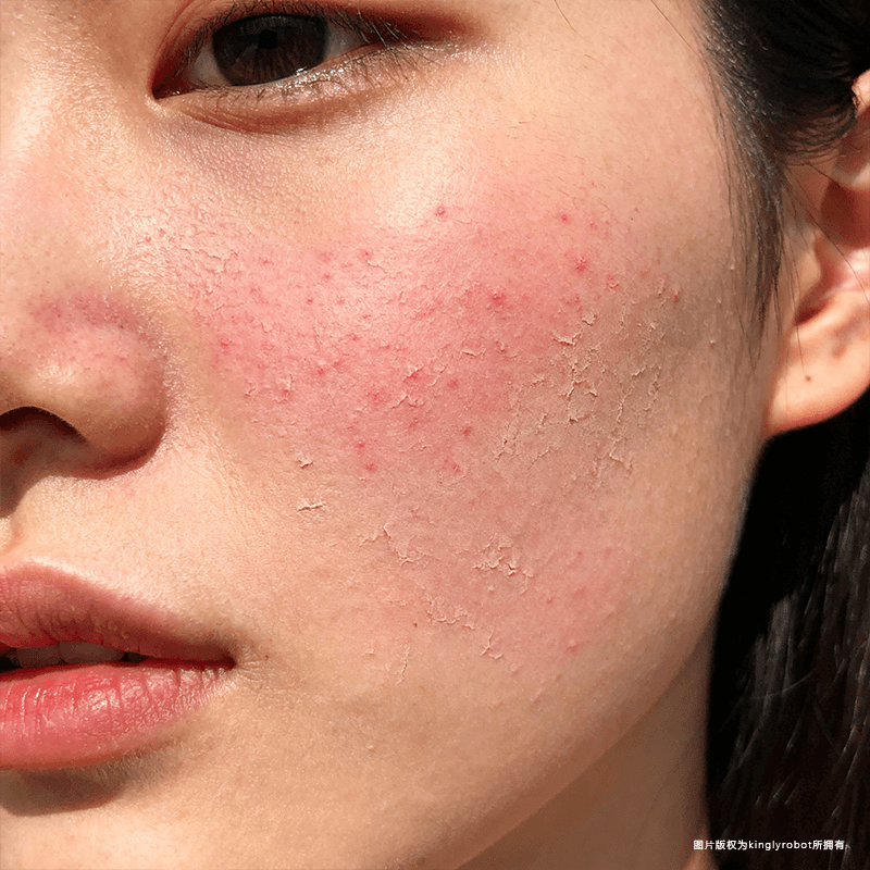 睡眠与皮肤修复机制