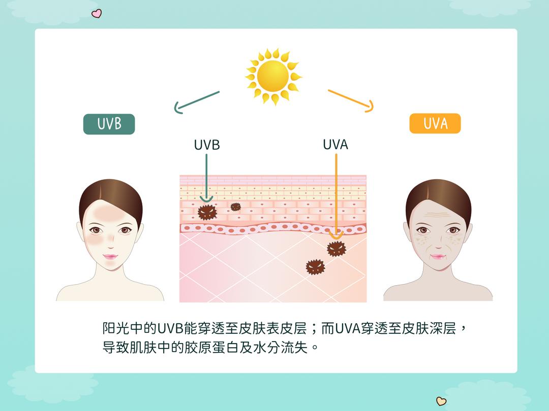 光化性皱纹